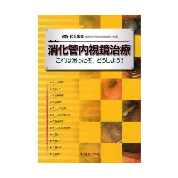 消化管内視鏡治療 これは困ったぞ,どうしよう