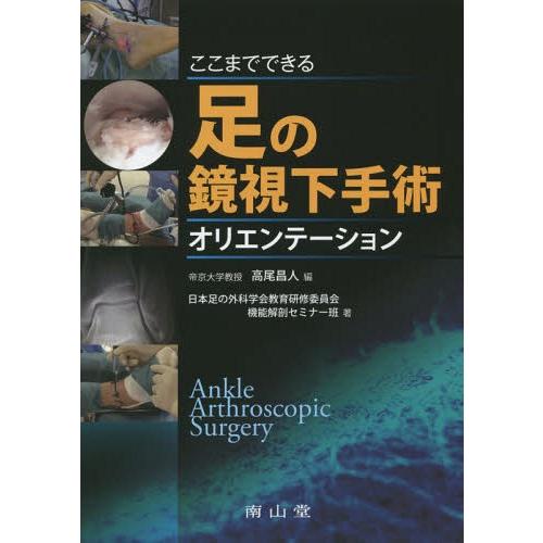 ここまでできる足の鏡視下手術オリエンテーション