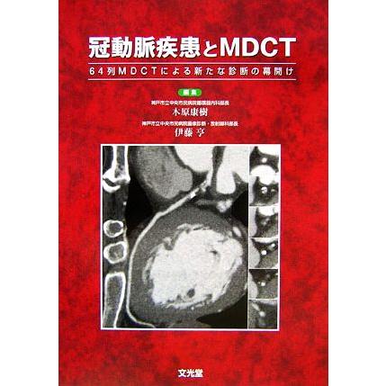 冠動脈疾患とＭＤＣＴ ６４列ＭＤＣＴによる新たな診断の幕開け／木原康樹，伊藤亨