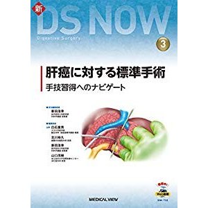 肝癌に対する標準手術 (新DS NOW 3)