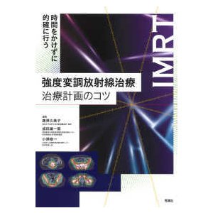 強度変調放射線治療治療計画のコツ-時間をかけずに的確に行う