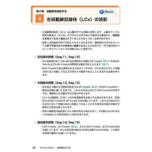 そうだったのか!  絶対読めるCAG?シェーマでわかる冠動脈造影の読み方