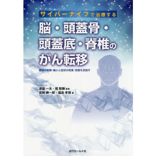 サイバーナイフで治療する脳・頭蓋骨・頭蓋底・脊椎のがん転移 腫瘍の制御・縮小と症状の改善・回復を目指す