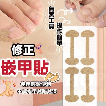 修正崁甲貼 正甲貼 糾正崁甲貼 甲溝炎矯正貼 指甲長肉裏腳拉拉貼  凍甲矯正貼 腳趾甲貼片 修護腳趾甲卷甲 甲溝嵌甲貼片