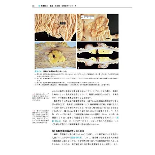 臨床に活かす病理診断学 第3版 消化管・肝胆膵編