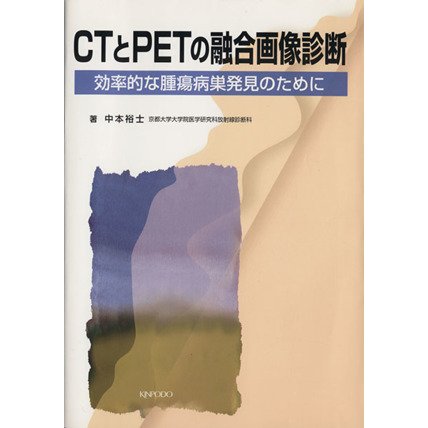 ＣＴとＰＥＴの融合画像診断　効率的な腫瘍病巣発見のために／中本裕士(著者)