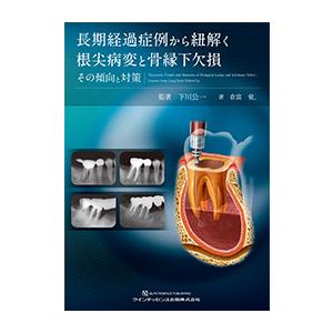 長期経過症例から紐解く根尖病変と骨縁下欠損 その傾向と対策