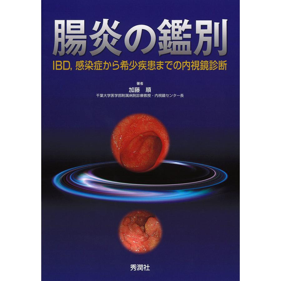 腸炎の鑑別 IBD,感染症から希少疾患までの内視鏡診断 加藤順