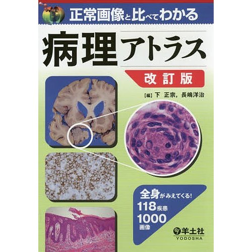 正常画像と比べてわかる 病理アトラス 改訂版 全身がみえてくる 118疾患1000画像