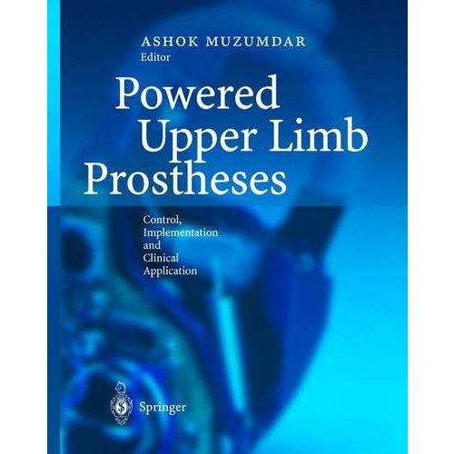 Powered Upper Limb Prostheses: Control, Implementation and Clinical Applica