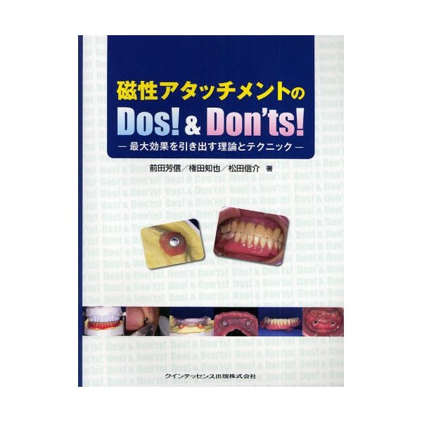 磁性アタッチメントのDos Don ts 最大効果を引き出す理論とテクニック