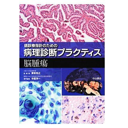 癌診療指針のための病理診断プラクティス　脳腫瘍／青笹克之，中里洋一