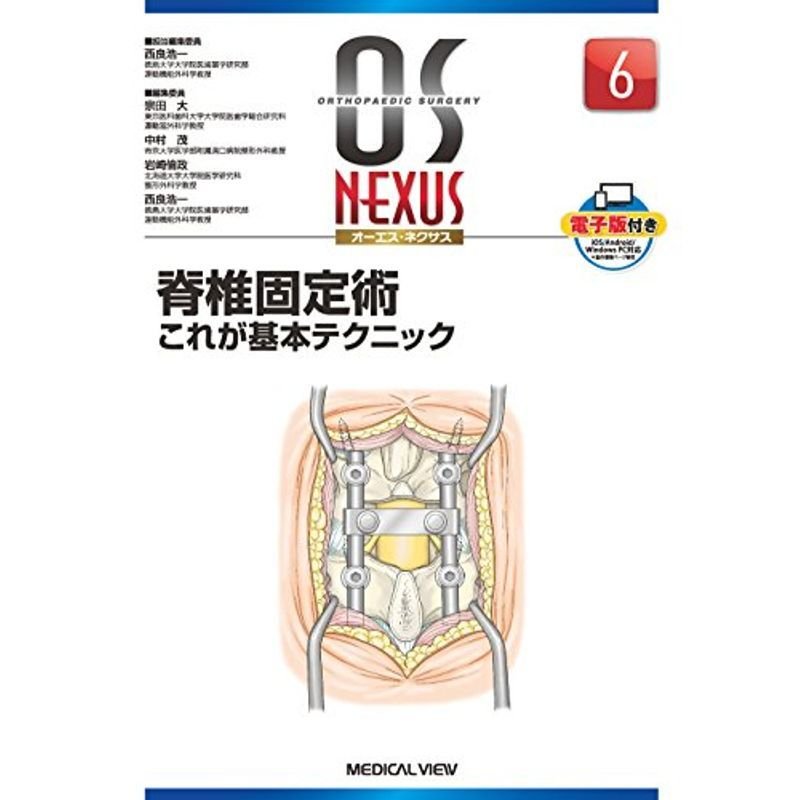 脊椎固定術−これが基本テクニック (OS NEXUS(電子版付き) 6)