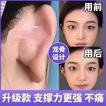 ⚡免運可開發票⚡升級耳貼精靈龍骨耳立隱形防水定型耳朵支撐器大臉招風耳直播神器優質