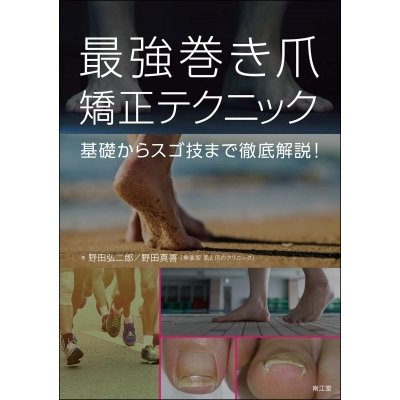 最強巻き爪矯正テクニック 基礎からスゴ技まで徹底解説!   野田弘二郎  〔本〕