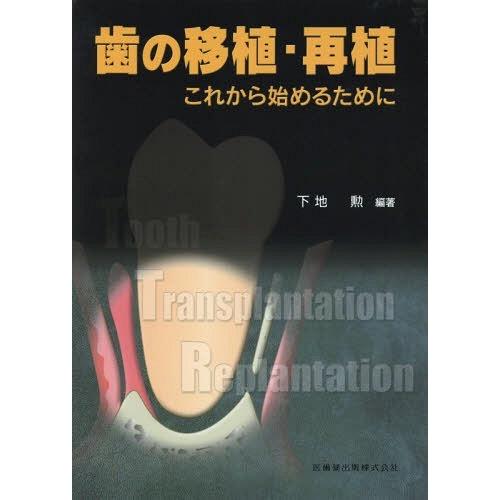 歯の移植・再植 これから始めるために