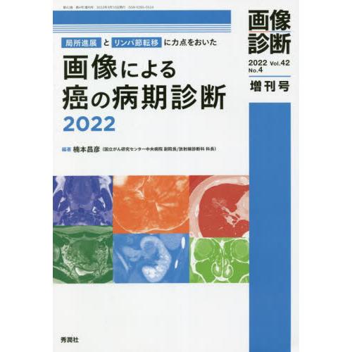 画像による癌の病期診断　局所進展とリンパ節転移に力点をおいた　２０２２