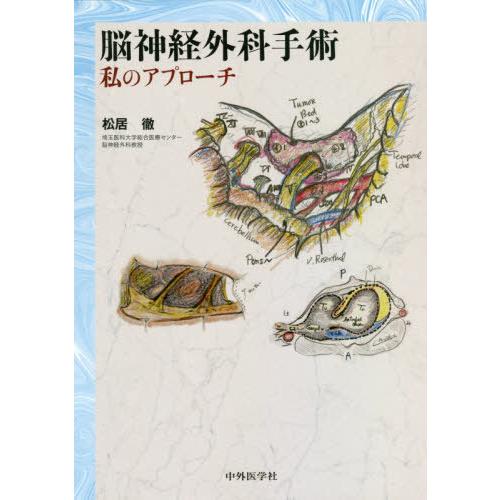 脳神経外科手術 私のアプローチ