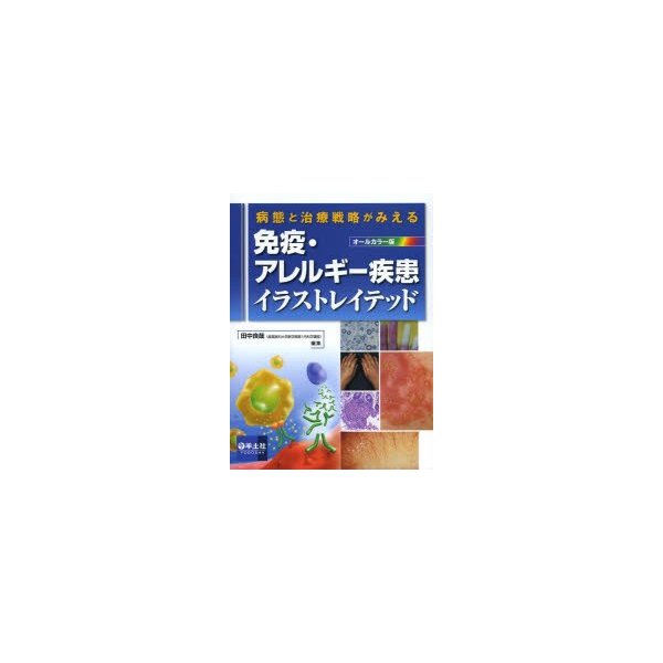 免疫・アレルギー疾患イラストレイテッド 病態と治療戦略がみえる