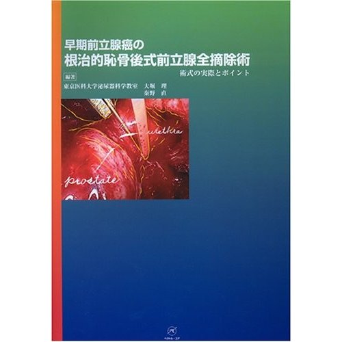 早期前立腺癌の根治的恥骨後式前立腺全摘除術?術式の実際とポイント?