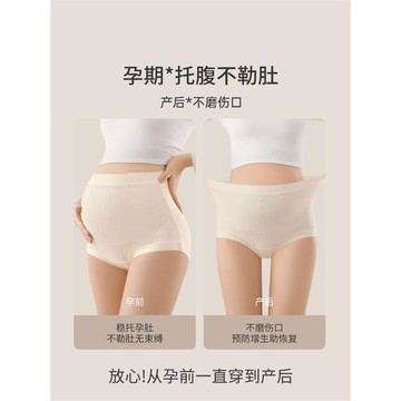 都市麗人孕婦內褲純棉大碼女懷孕期專用抗菌早中晚期產后高腰短褲