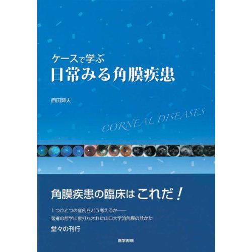 [A01207162]ケースで学ぶ日常みる角膜疾患