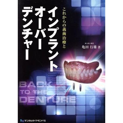 これからの義歯治療とインプラントオーバー／亀田行雄(著者)