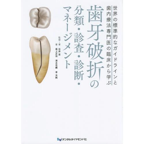 歯牙破折の分類・診査・診断・マネージメント 世界の標準的なガイドラインと歯内療法専門医の臨床か