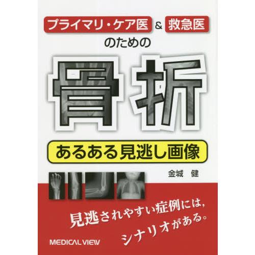 プライマリ・ケア医 救急医のための骨折あるある見逃し画像 金城健