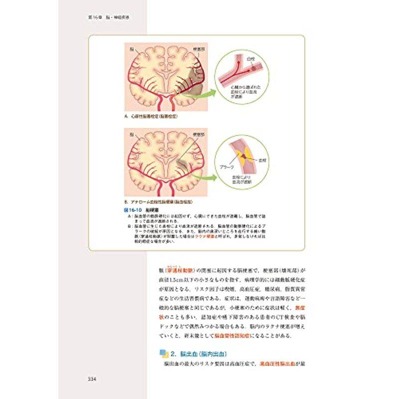 なるほどなっとく病理学 plus: 病態形成の機序と各器官の疾病の特徴