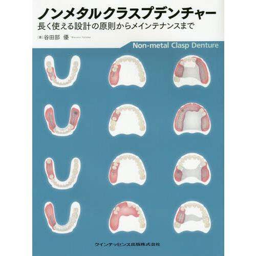 ノンメタルクラスプデンチャー 長く使える設計の原則からメインテナンスまで