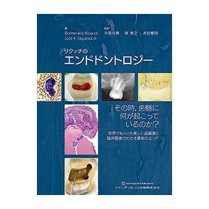 リクッチのエンドドントロジー その時，歯髄に何が起こっているのか? 世界でもっとも美しい組織像と臨床画像でわかる最新のエンド