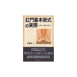 肛門基本術式の実際 岩垂純一