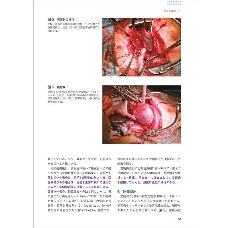 産婦人科手術スタンダード