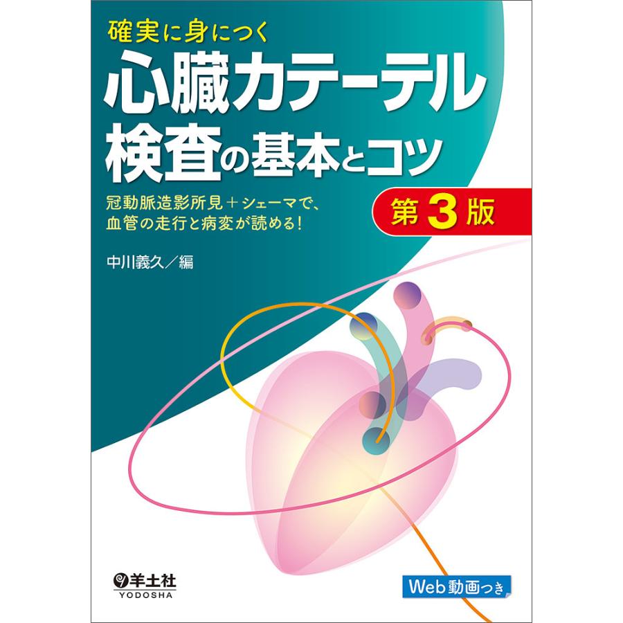 確実に身につく心臓カテーテル検査の基本とコツ 冠動脈造影所見 シェーマで,血管の走行と病変が読める