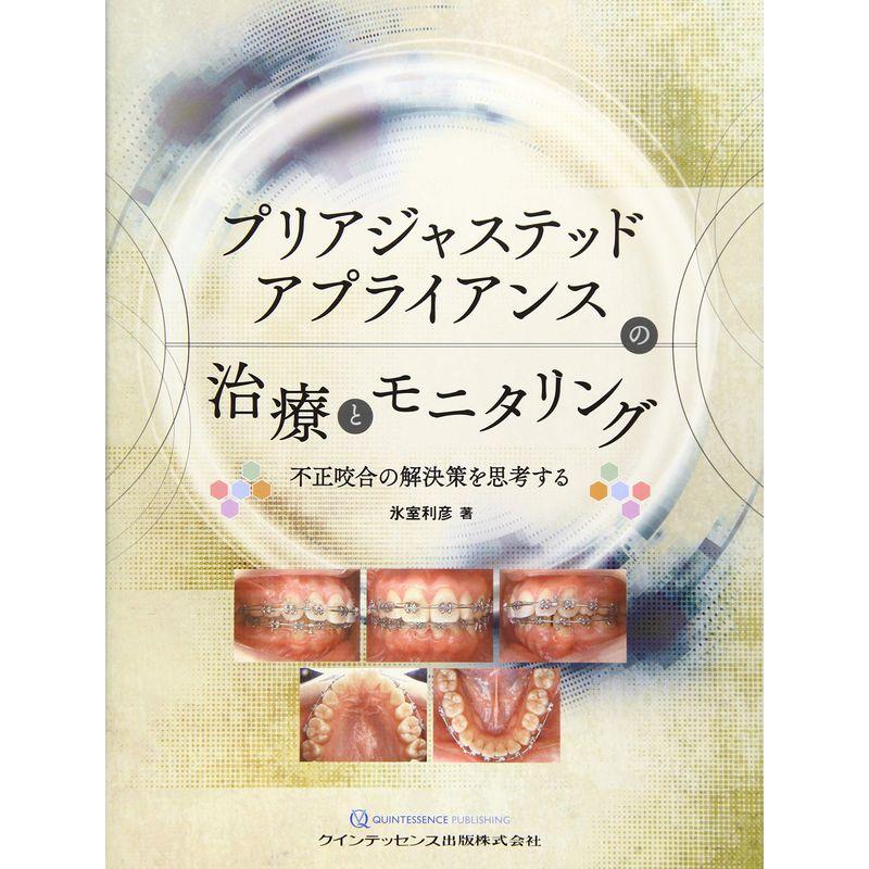 プリアジャステッドアプライアンスの治療とモニタリング