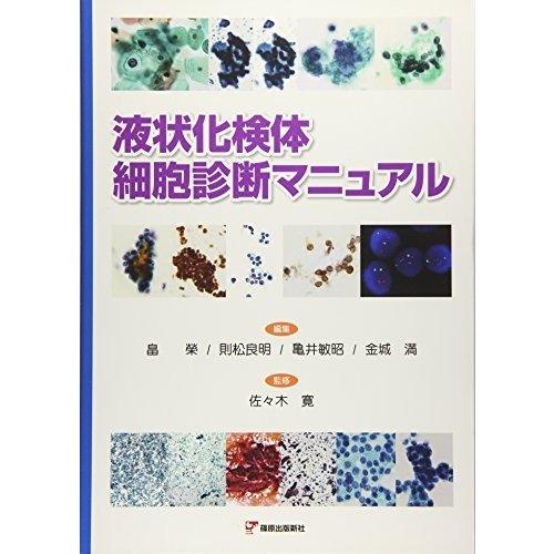 液状化検体細胞診断マニュアル