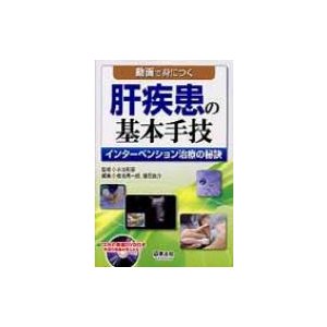 動画で身につく肝疾患の基本手技 インターベンション治療の秘訣   椎名秀一朗  〔本〕