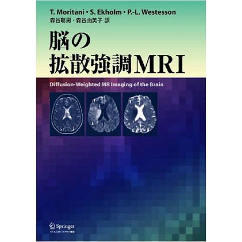 脳の拡散強調MRI