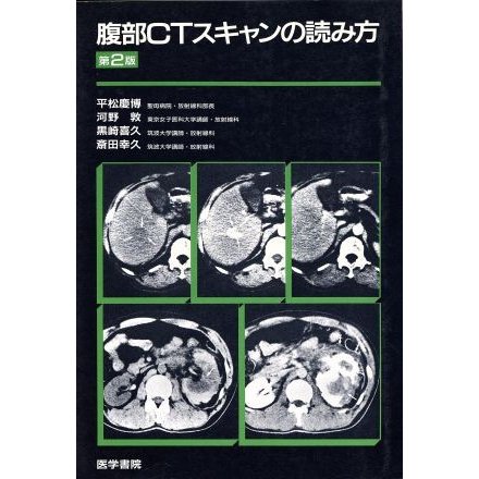 腹部ＣＴスキャンの読み方　第２版／平松慶博(著者)