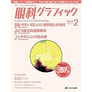 眼科グラフィック 2017年2号(第6巻2号)特集:間違いやすい判定しにくい視野