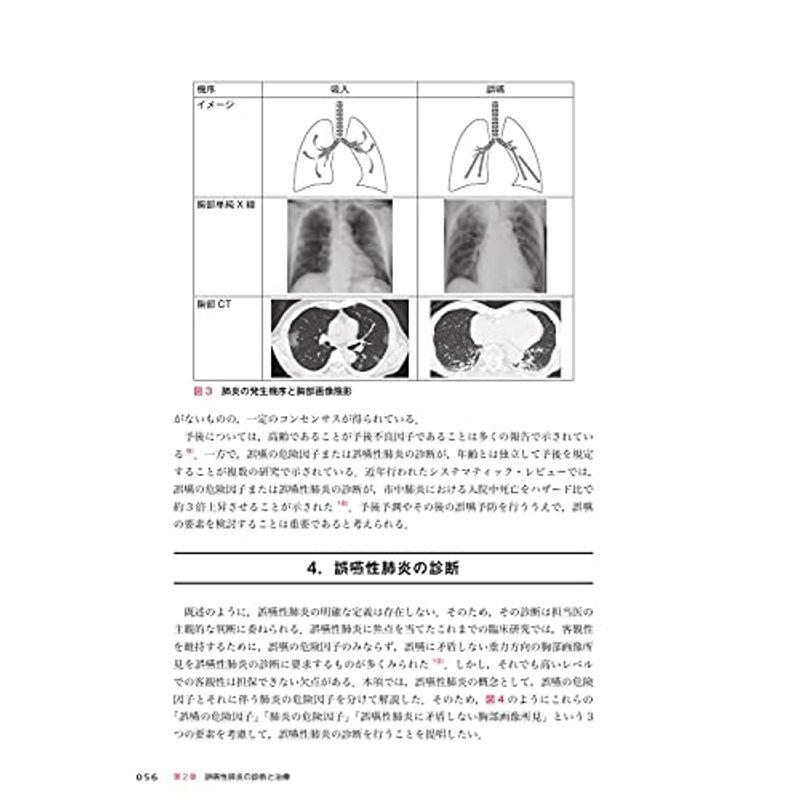 誤嚥性肺炎の包括的アプローチ 診断・治療から,栄養管理・呼吸リハ・嚥下リハ・口腔ケアまで