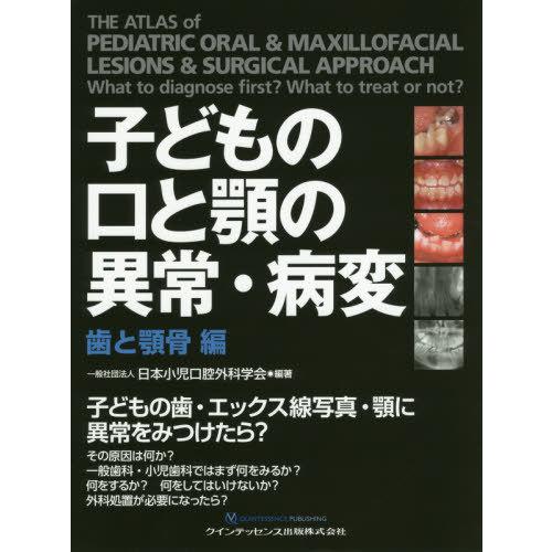 子どもの口と顎の異常・病変 歯と顎骨編 日本小児口腔外科学会