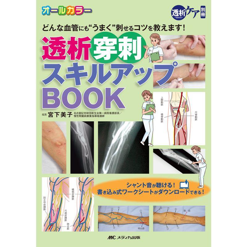 透析穿刺スキルアップBOOK どんな血管にも うまく 刺せるコツを教えます