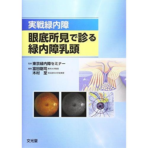 [A11779270]実戦緑内障 眼底所見で診る緑内障乳頭