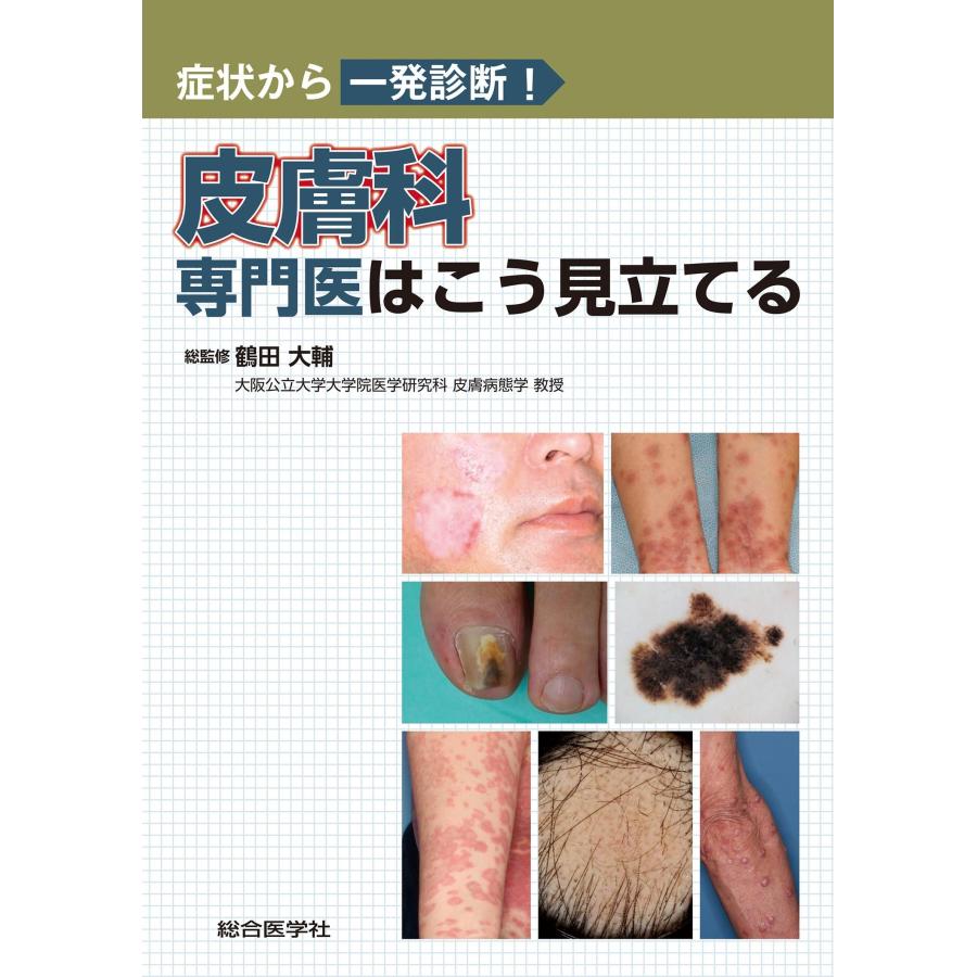 皮膚科専門医はこう見立てる 症状から一発診断