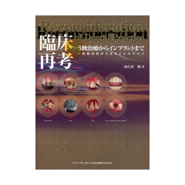 臨床再考・う蝕治療からインプラントまで 一般臨床医ができることのすべて