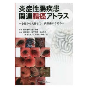 炎症性腸疾患関連腸癌アトラス-小腸から大腸まで、肉眼像から迫る