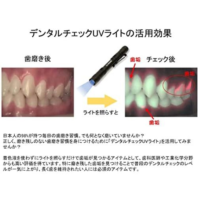 デンタルチェック UVライト 磨き残し デンタルケア セルフチェック 歯垢 発光 | LINEショッピング