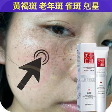 【現貨速發】🔥美白淡點面霜黑色素 日常淡化 老年點補水面霜 黑點 黃褐 補水保溼霜 補水保濕提亮膚色提亮面霜